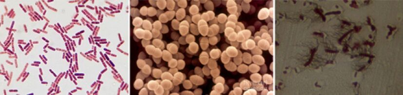 E. coli, fecal enterococci and proteus are the main causative agents of chronic bacterial prostatitis
