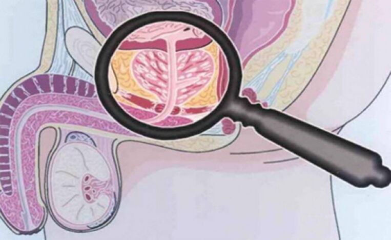 Prostate and its location